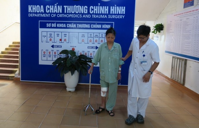 Thay khớp gối thành công cho bệnh nhân 56 tuổi