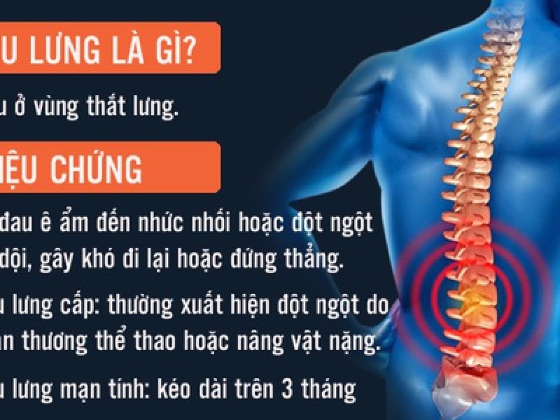 Mọi điều cần biết về đau lưng