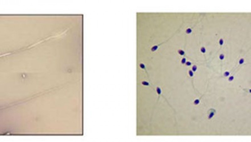 Thêm tin vui cho các vợ chồng hiếm muộn: Tinh trùng bất động vẫn được làm bố