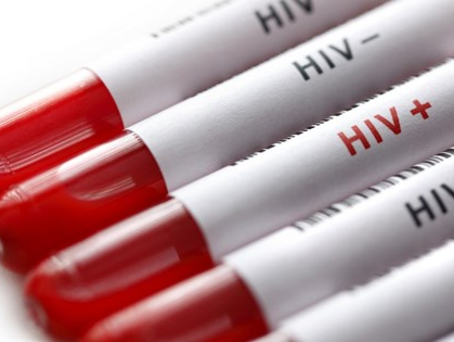 Phát hiện thuốc điều trị ung thư phổi có thể tiêu diệt các tế bào HIV